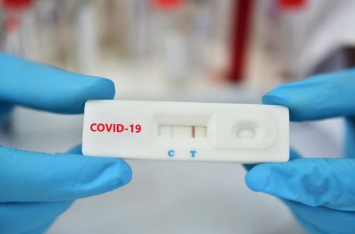 Tphcm Trien Khai Test Nhanh Covid 19 Ufdm