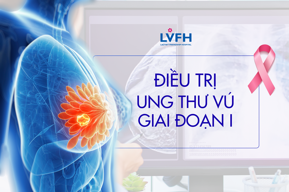 Điều trị Ung thư vú giai đoạn 1