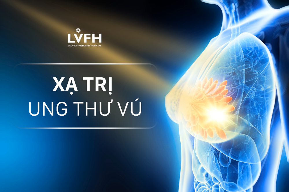 Xạ trị là một trong những phương pháp điều trị Ung thư vú hiệu quả.