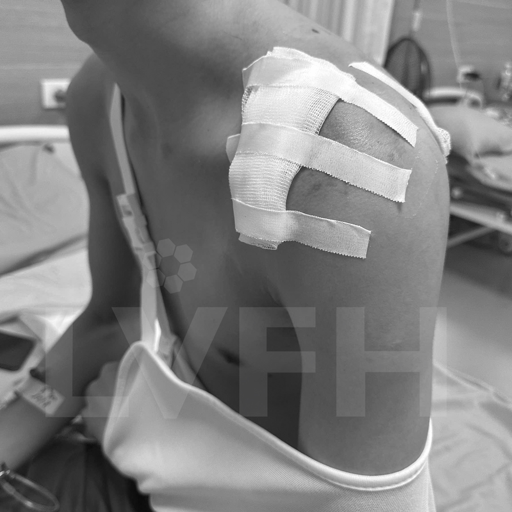 Vết thương sau mổ của bệnh nhân rất nhỏ.